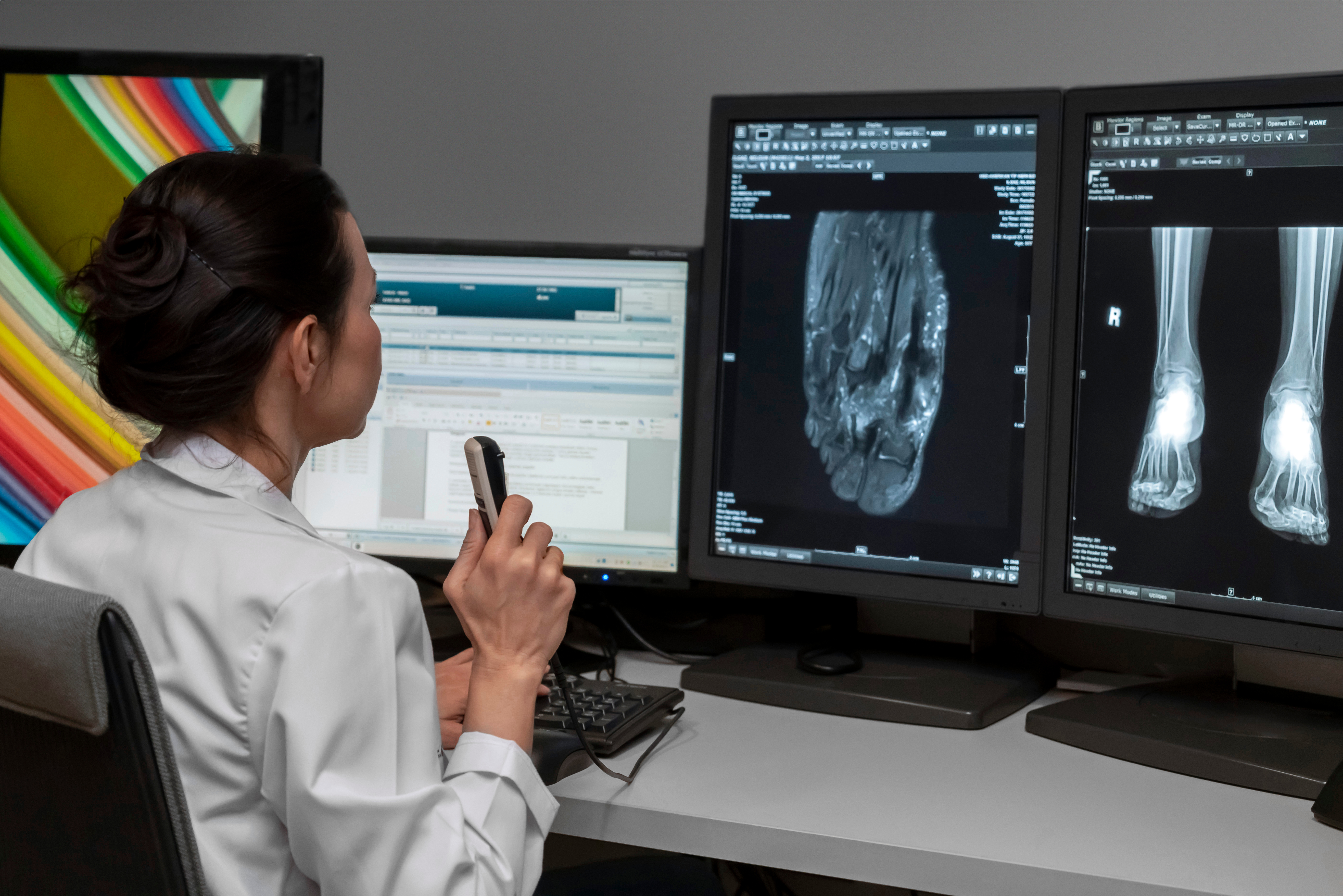 Radiology AI trends at RSNA 2023