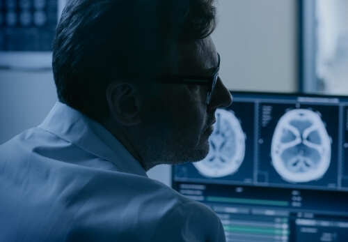 a doctor wearing glasses looking at brain scans