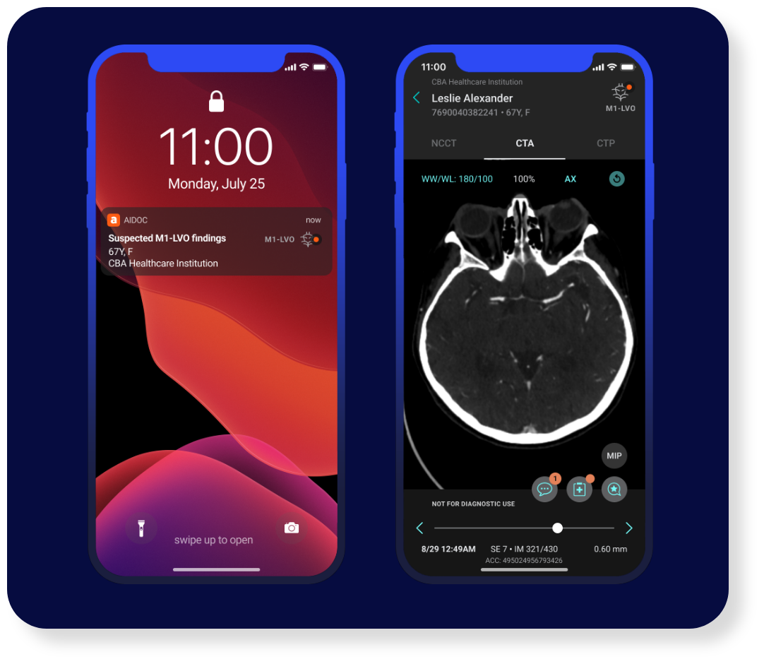 Ai imaging on a IPhone