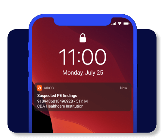 Aidoc VTE Solutions Suspected PE findings mobile notification banner on a smartphone