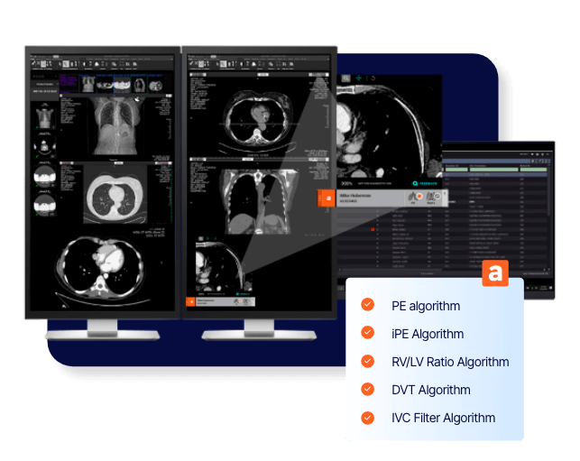 Aidoc VTE Solutions Triage and Notification Algorithm screens