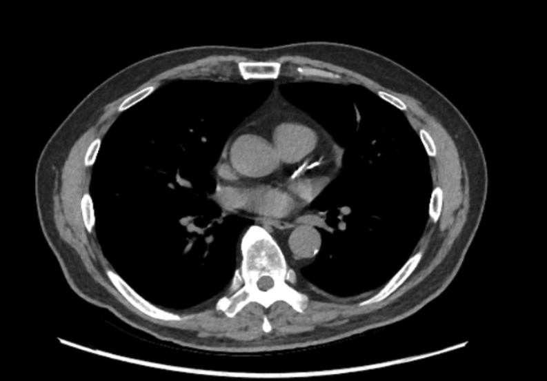 AI medical imaging of spin and body cavity