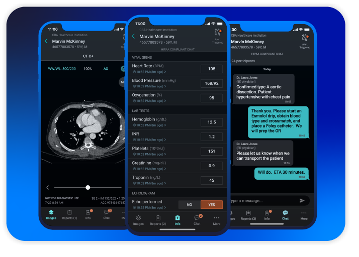 Aidoc’s Care Coordination cross-specialty workflows communication dashboards on three smartphones