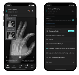 mobile interface displaying AI medical imaging alongside a checklist of diagnostic findings