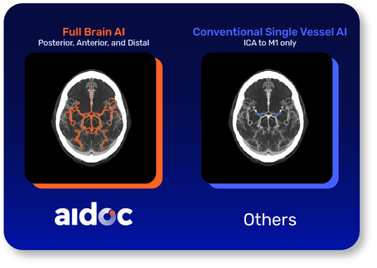 Aidoc Full Brain Solution leverages both image-based and NLP for a better user experience.
