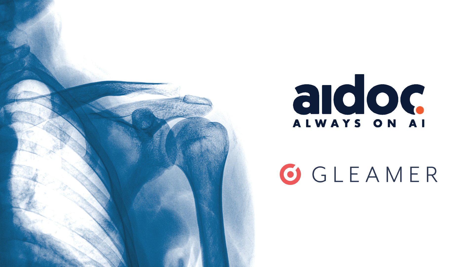 Aidoc partnership with Gleamer