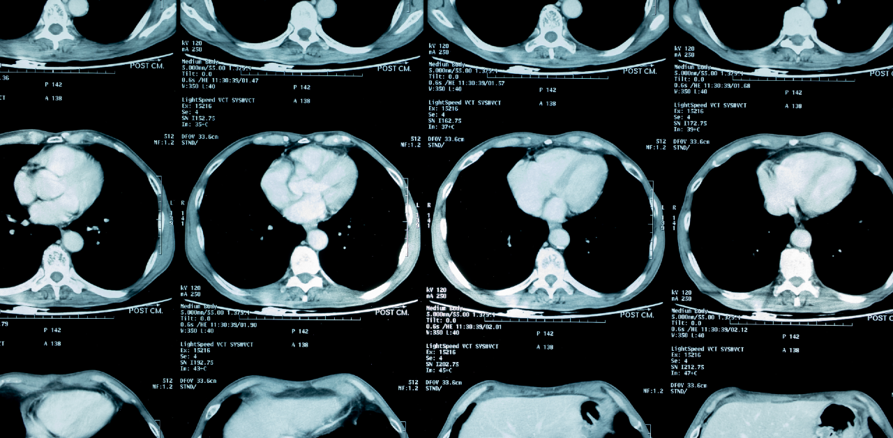 AI for radiology in Europe