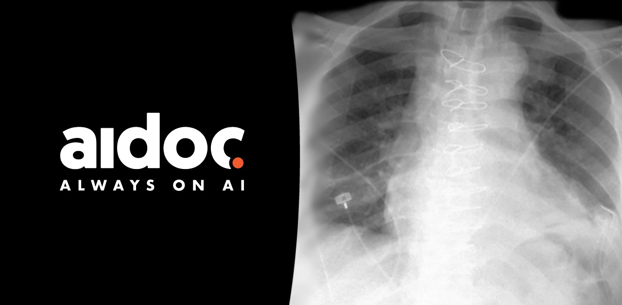 The Aidoc logo with an xray