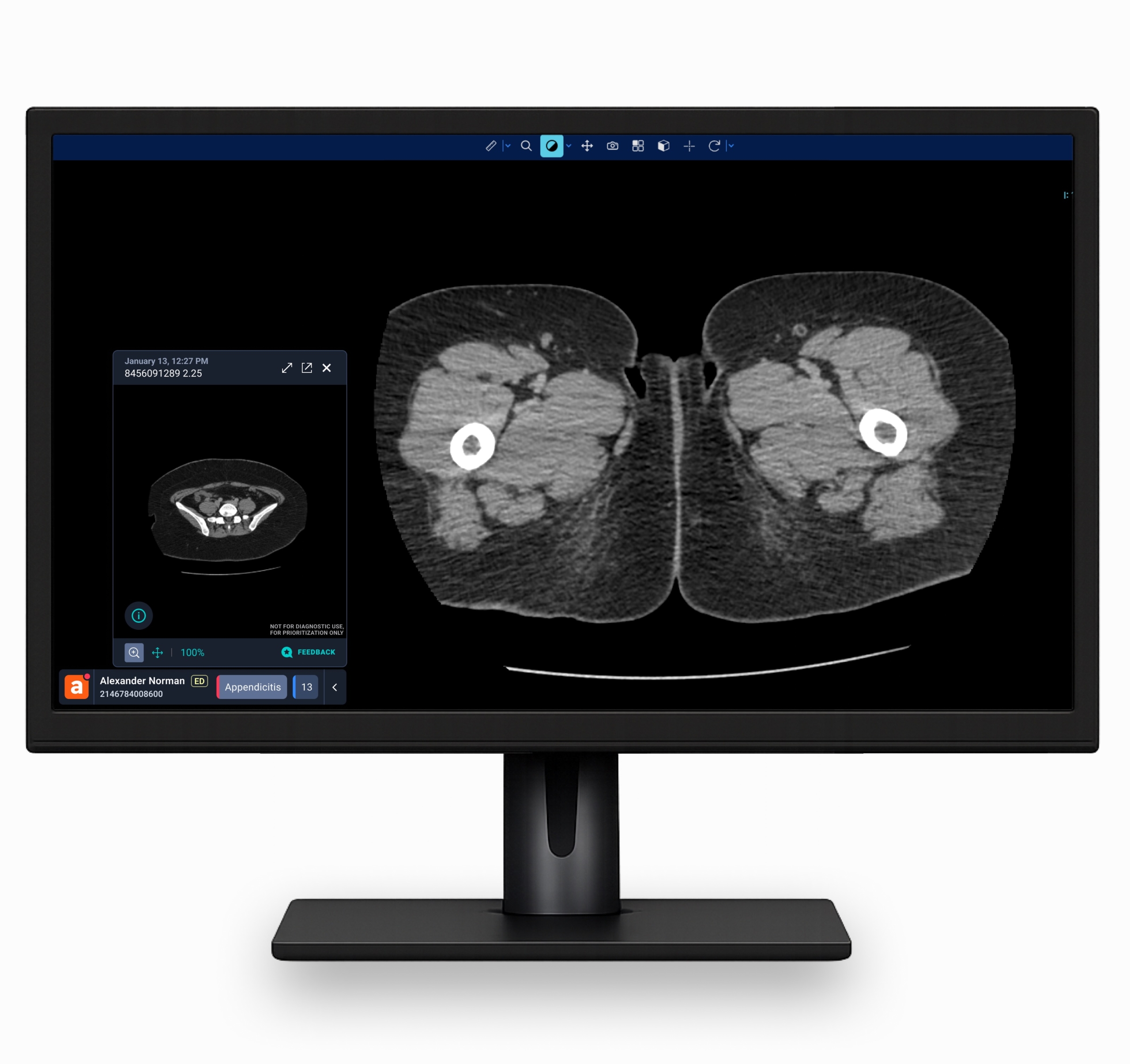 Aidoc Product Interface
