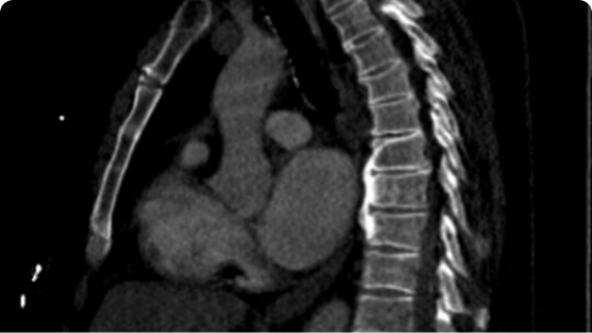 AI imaging of someones chest side view