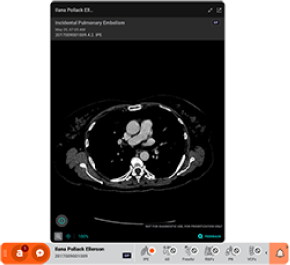 AI medical imaging interface displaying a chest scan with annotations, highlighting automated awareness capabilities in radiology software