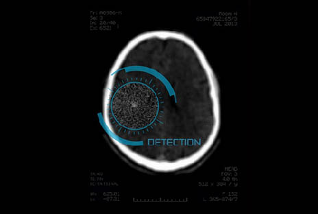 ai detection