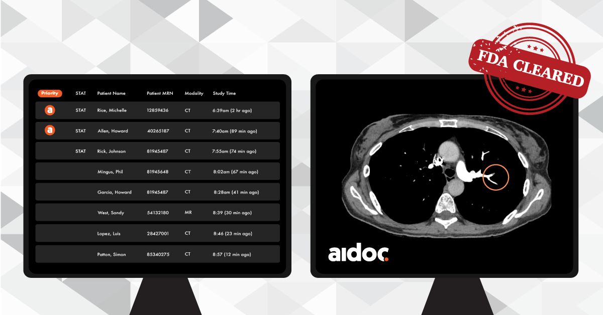 An image of Aidoc's platform interface