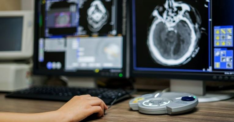 Radiologist on computer with scans