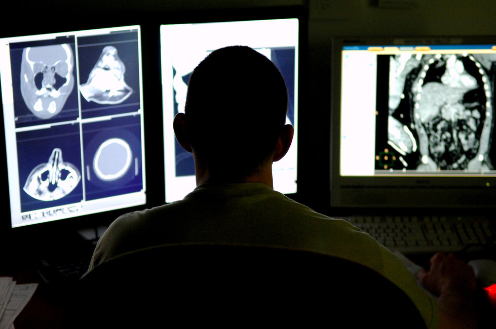 A radiologist analyzing scanning and imaging