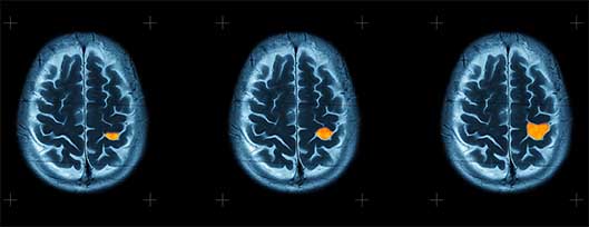 An image of an ai brain