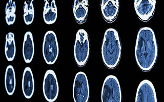 an image of a brain scan